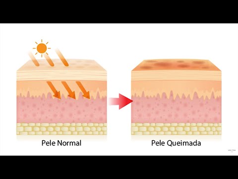 Vídeo: Qual uv é mais prejudicial?