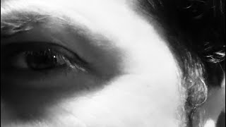 Saçlarım, Size Ne Oldu?