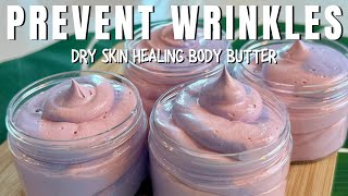 DIY Whipped Body Butter HOW I PREVENT WRINKLES & HEAL DRY SKIN