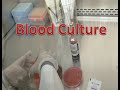 Episode 17 Blood Culture