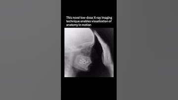 Hand & face movement seen for the FIRST-TIME with dynamic X-Ray #anatomy #radiology #medicalstudent
