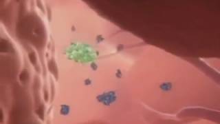 Why We Go Bald Hair Loss Explained Excerpt From Bbc Documentary On Hair Transplants