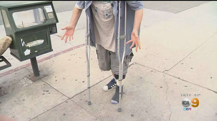 Victim Of Hit-And-Run Driver Wants Woman Who Mowed Him Down To Come Forward