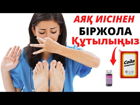 Бейне: Акуланы қалай кетіруге болады?