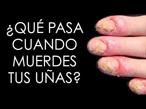 Video: El Hábito De Chuparse Los Dedos Y Morderse Las Uñas: ¿vale La Pena Luchar?