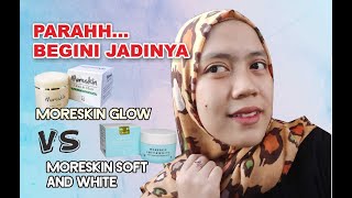 BATTLE MORESKIN GLOW DENGAN MORESKIN SOFT AND WHITE NASA//GLOWING PARAH..! screenshot 4