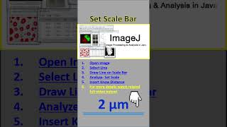 Set Scale Bar in ImageJ Software
