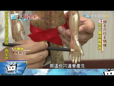 20170518中天新聞　「針」厲害！　英研究：針灸穴道能「治憂鬱症」