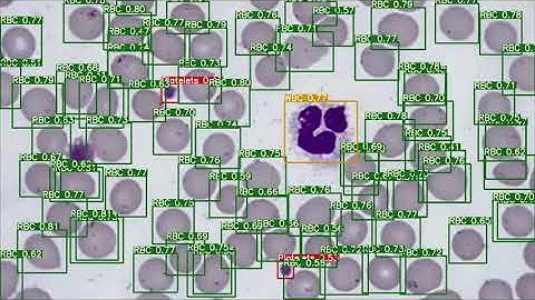 Machine learning approach of automatic identification and counting of blood cells