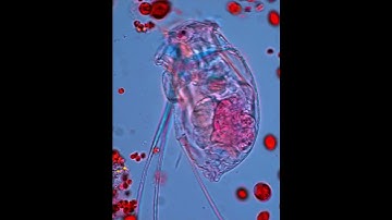entinity virus 🦠 zombie #trending #viral #viralvideo #shortvi #yt #ytshorts #short #science #shorts
