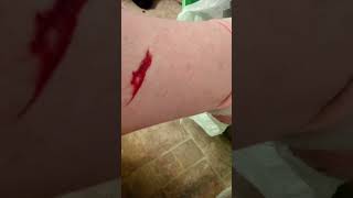 was impressed how a red inanimate object could bite me. is this banned?