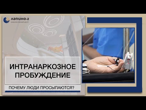 Интранаркозное пробуждение  Возможно ли проснуться во время операции? Рассказывает врач.