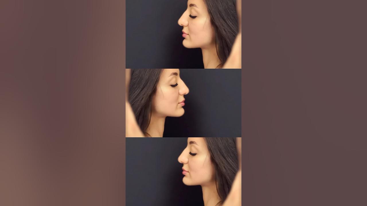 эстет пластик