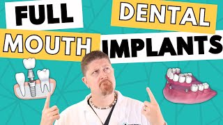 What are FULL MOUTH Dental Implants?
