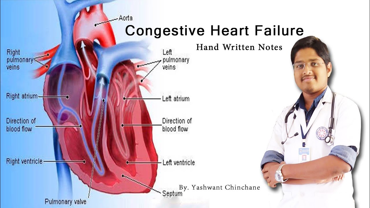 CONGESTIVE HEART FAILURE - YouTube