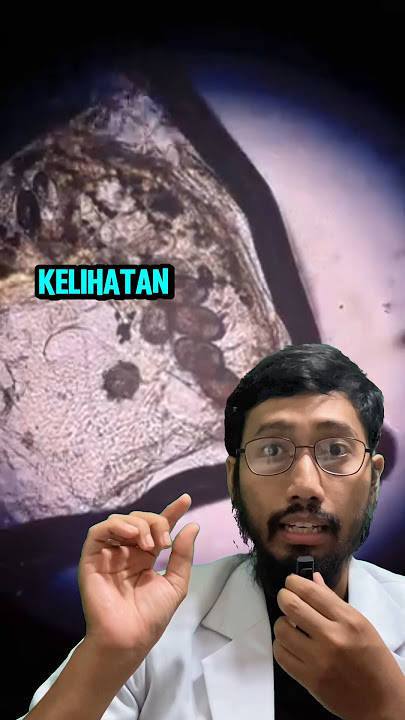 YOUR BODY BECOMES A NEST FOR THIS ANIMAL‼️Very ITCHING 😣😫 #uniquefacts #healthfacts