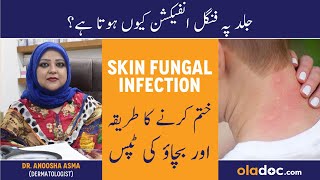 Skin Fungal Infection Treatment In Urdu/Hindi- Dad Khad Ka Ilaj - Skin Pe Fungus Kese Hota Hai screenshot 5