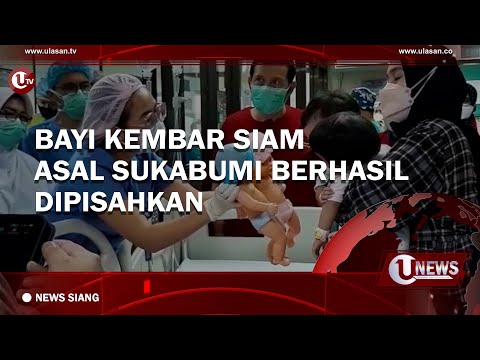BAYI KEMBAR SIAM ASAL SUKABUMI BERHASIL DIPISAHKAN | U-NEWS