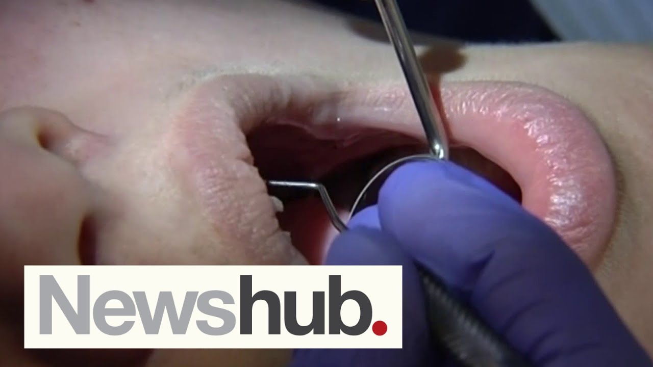 NZ dentists call for free dental care as new figures reveal deteriorating oral health | Newshub