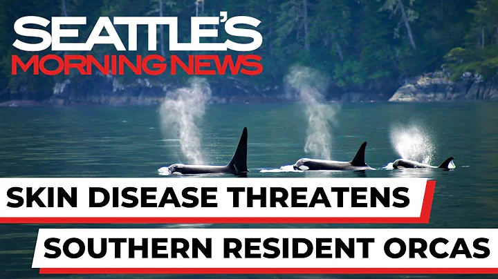 Skin disease threatens Puget Sound's endangered southern resident orcas