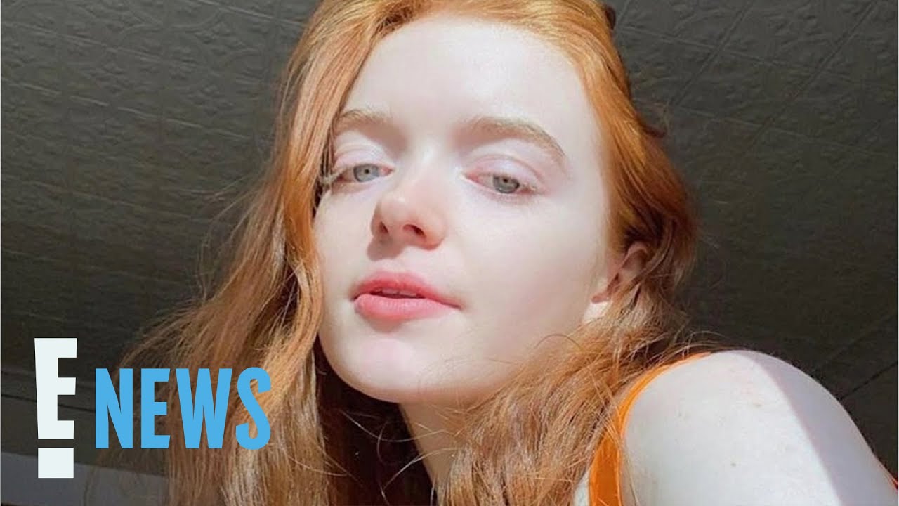 Dancer Órla Baxendale Dead at 25 After Eating Mislabeled Cookie | E! News Dancer Órla Baxendale Dead at 25 After Eating Mislabeled Cookie | E! News