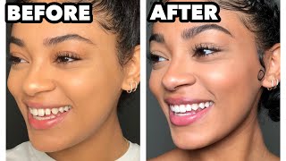 Hey everyone!! some of you have noticed but havent! my gaps are gone!
earlier in the year i started invisalign.. best decision mad...