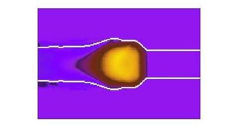 FELBA: Lattice Boltzmann simulation of blood flow in deformable vessel