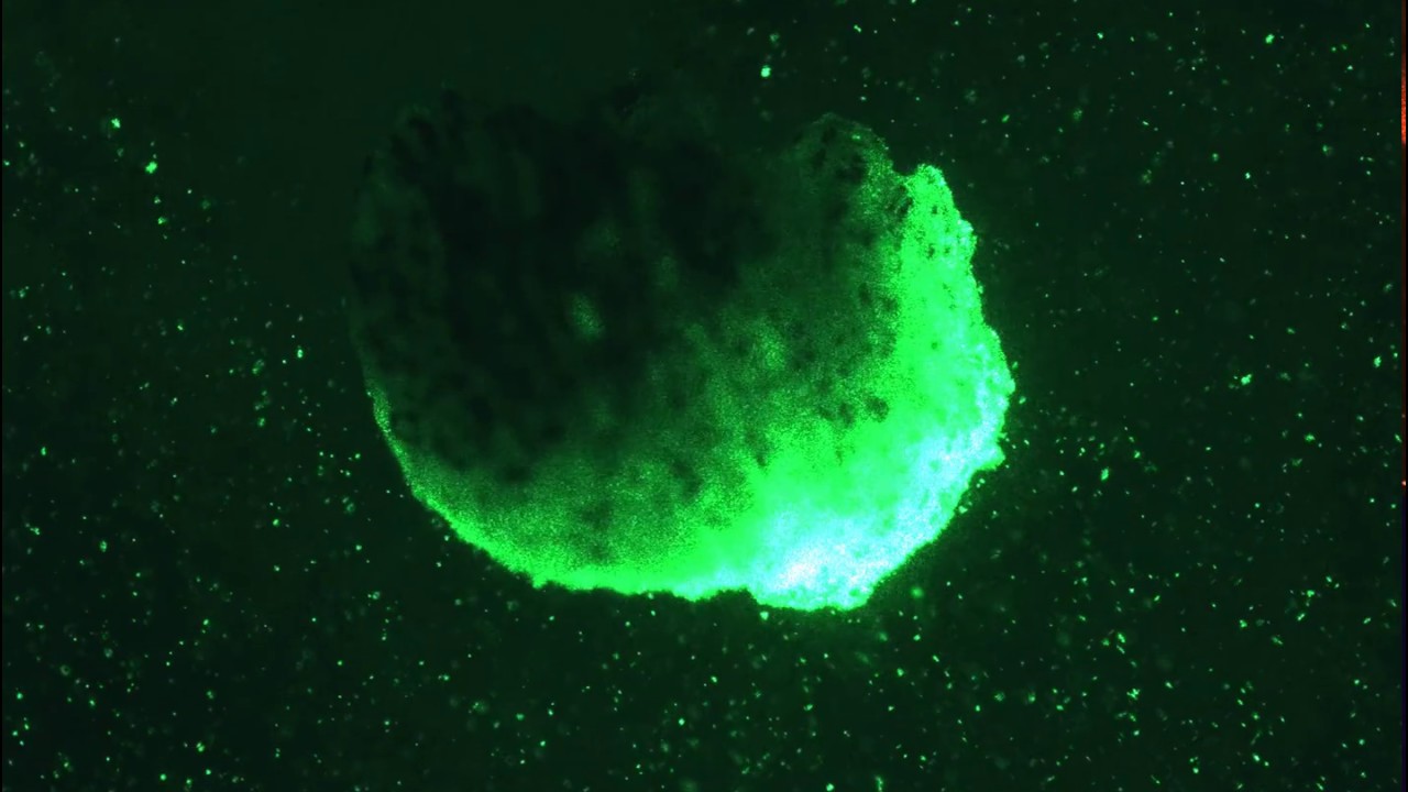 Armina rhinophore with glass particles and laser sheet