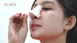 Kiến thức nâng mũi|Hướng dẫn tháo nẹp tại nhà