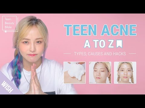 Teen Acne | Acne Meaning & Acne Treatment for Teenage Girls and Boys