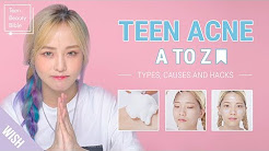 Teen Acne | Acne Meaning & Acne Treatment for Teenage Girls and Boys | Wish Beauty 101