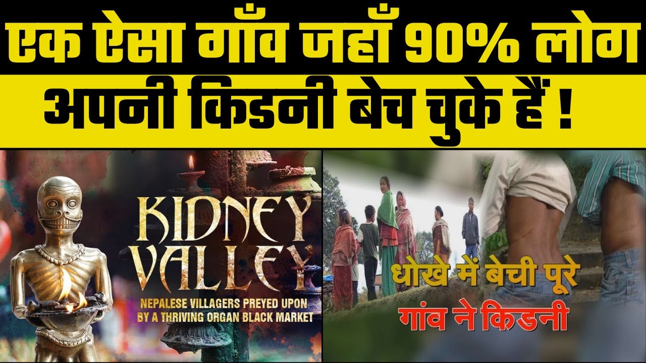 Kidney Valley: Nepal का Hokse गाँव जहां लोगों की सिर्फ एक किडनी है