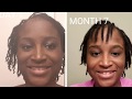 7 month loc update| 2 strand twist