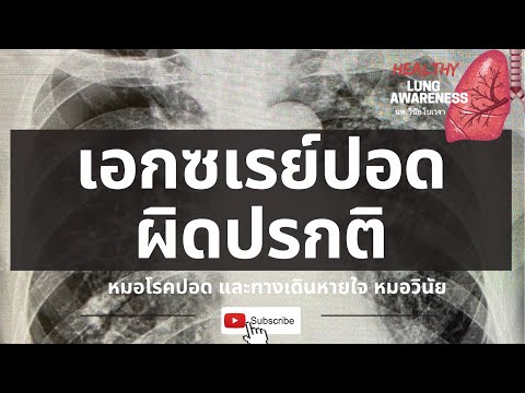 เอกซเรย์ปอดผิดปรกติ |สิ่งที่คุณต้องรู้ | นพ.วินัย โบเวจา