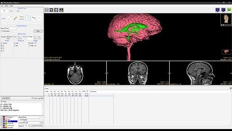 Analyze 15.0 - Measure: Sample Angles