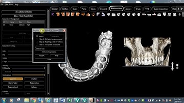 Easily Import Any Digital Impression to Invivo™, with KaVo™ and i-CAT™
