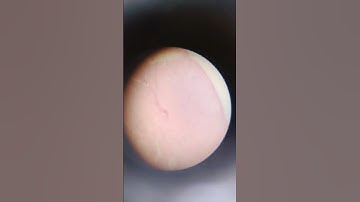 Activity 7 (FSC Part II) Examination of prepared slides of Ovary.