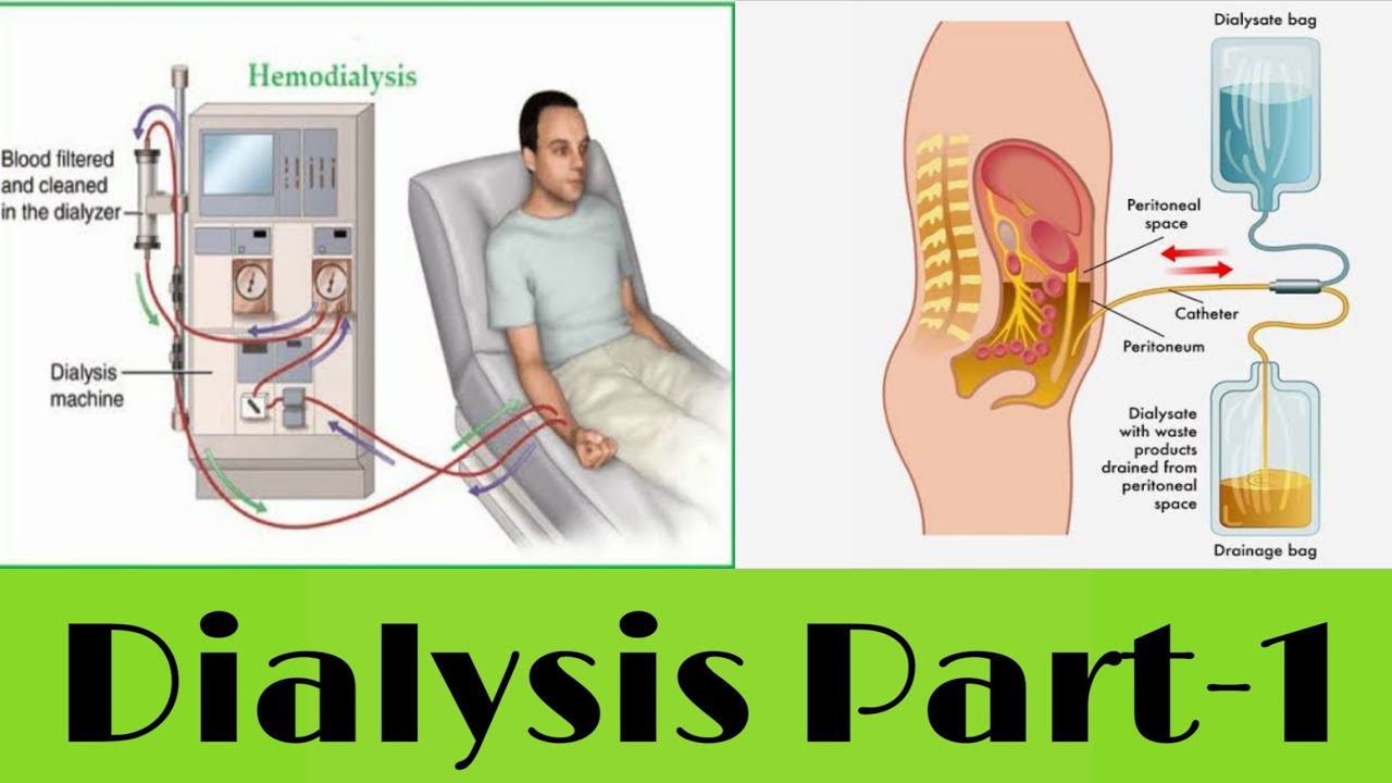 dialysis-types-method-and-basic-info-youtube