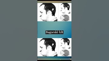 Man Who Survived a Particle Beam to the Head