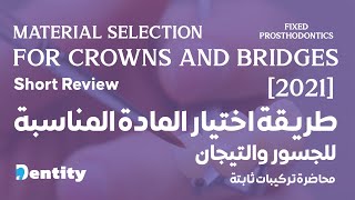 طريقة اختيار المواد المناسبة للجسور والتيجان | Material Selection for Crowns and Bridges