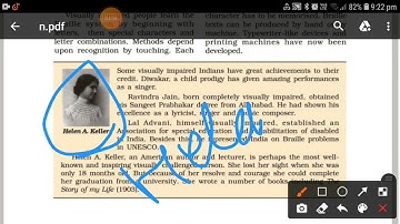 non optical nerve and optical nerve class 8 Science  chapter 16 light