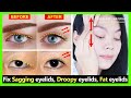 Get Big eyes view and natural Double eyelids. Fix sagging eyelids, droopy eyelids and fat eyelids.
