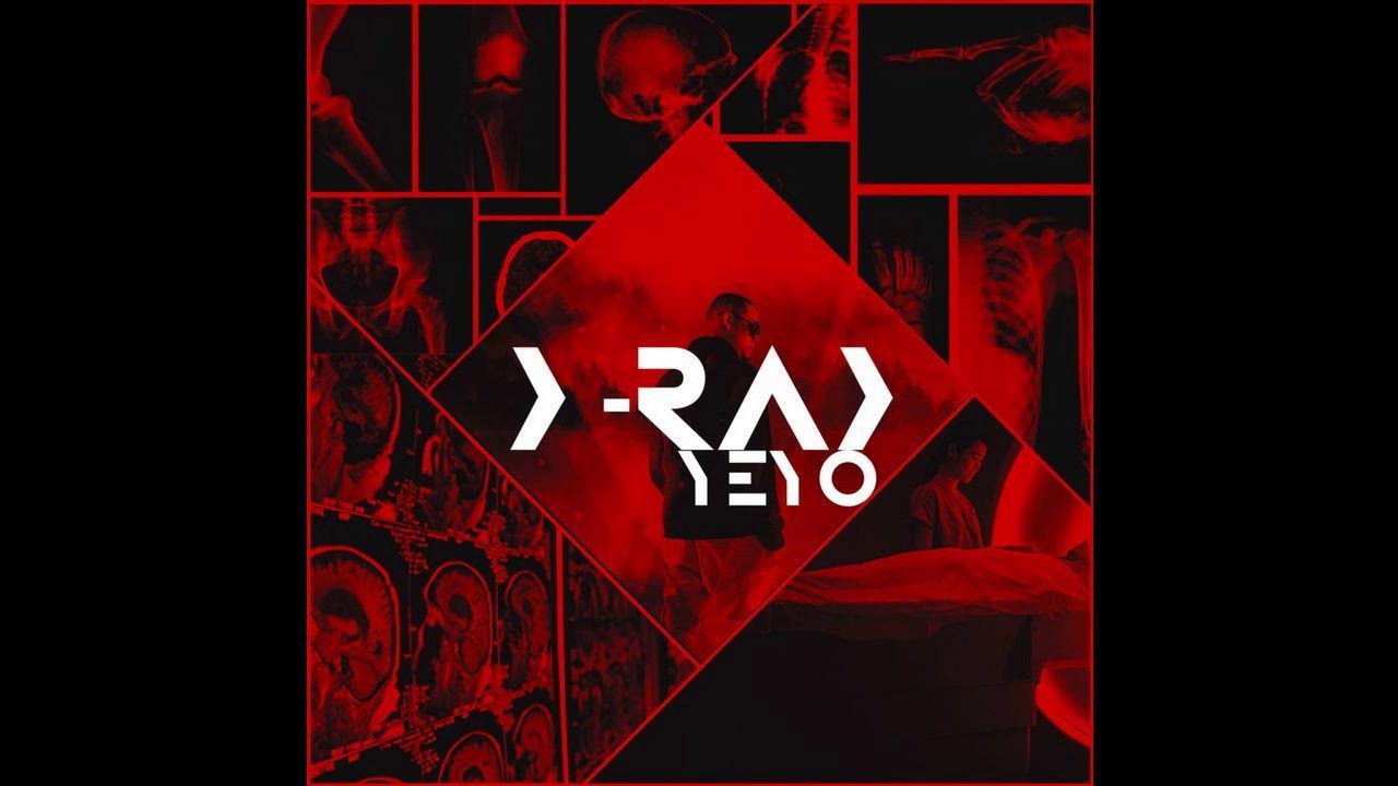 Watch Yeyo - X-Ray on YouTube Watch Yeyo - X-Ray on YouTube