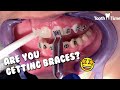 Braces on | Tooth Time Family Dentistry New Braunfels