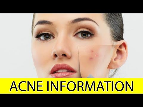 acne-information