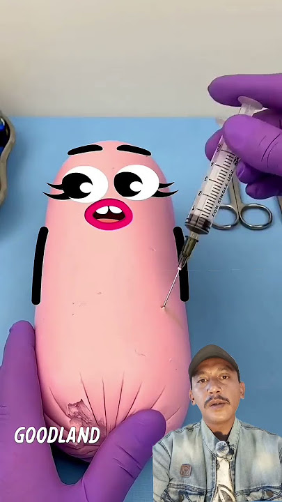 Ada Benda Asing Dalam Perut‼️@GOODLANDTV #animation #funny #cartoon #remix #shorts #wood #sosis