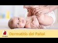 Dermatitis del Pañal (Amoniacal)