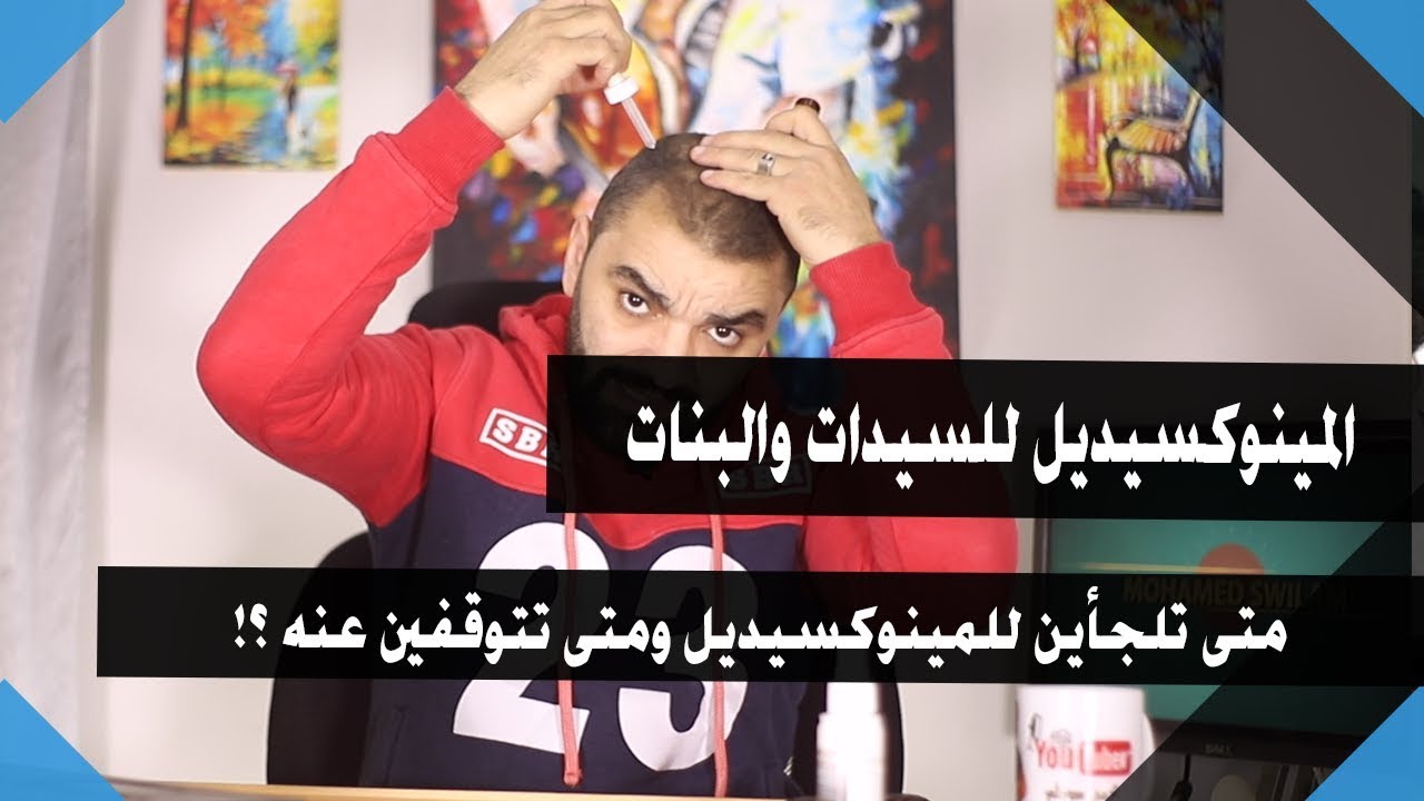 المينوكسيديل للنساء قبل وبعد الزواج والحمل  لعلاج تساقط الشعر