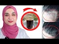 ماسك طبيعى رهيب لانبات و تطويل الشعر بسرعةو ايقاف التساقط الشديد بمكونات في كل بيت نتيجة في أسبوعين 