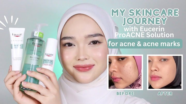 Eucerin pro acne solution review sheis năm 2024